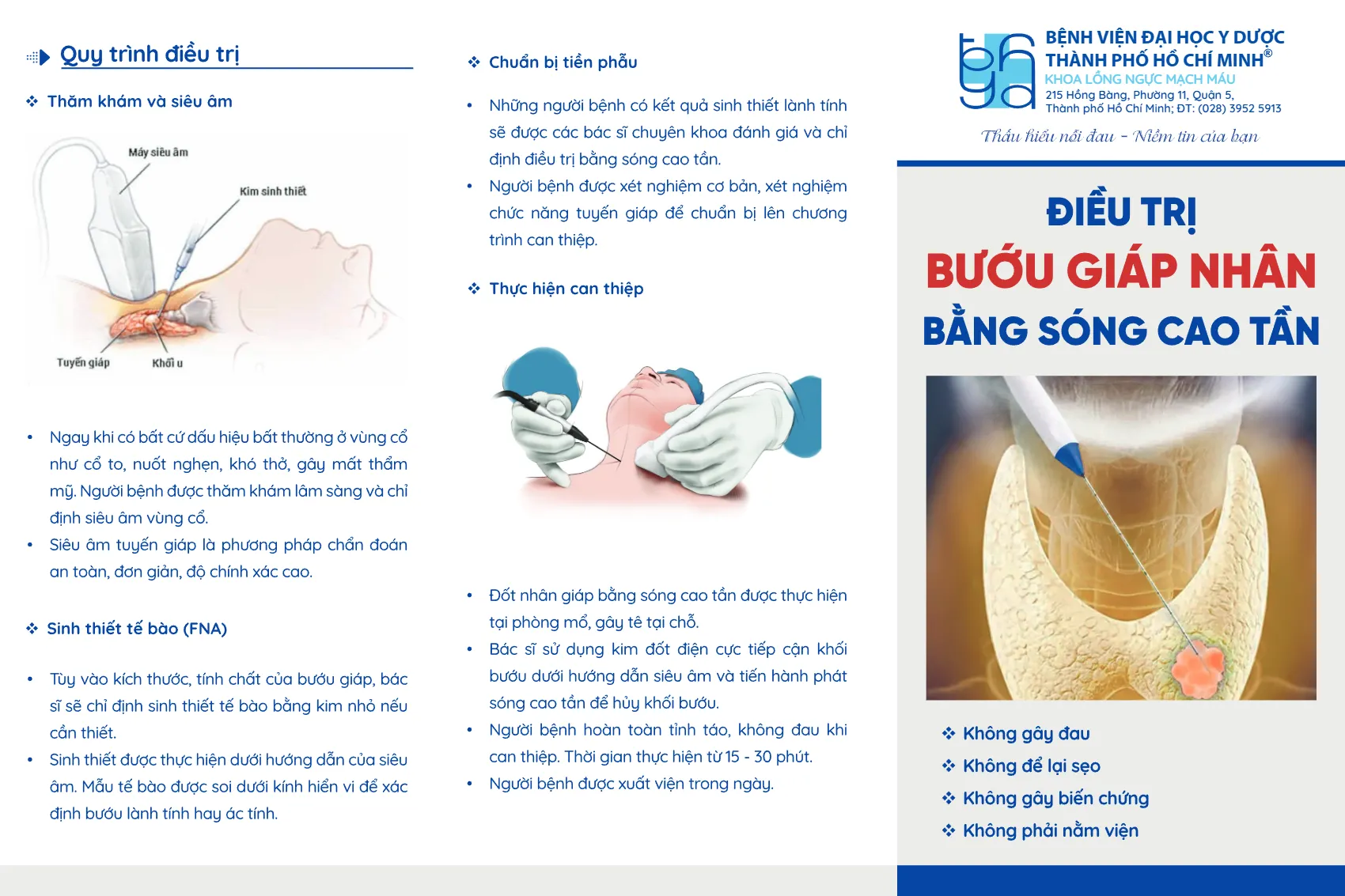 to roi dieu tri buou giap nhan bang song cao tan_1.webp